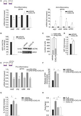 CXCL16/CXCR6 Axis Drives Microglia/Macrophages Phenotype in Physiological Conditions and Plays a Crucial Role in Glioma